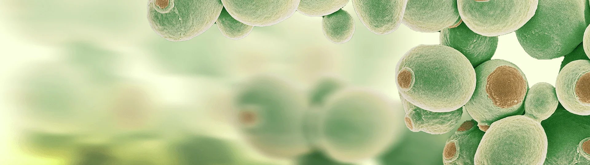 yeast_expression_system_banner